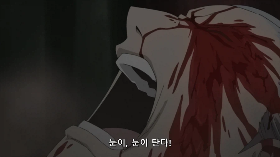 강철) 인체 연성 성공.jpg_1.webp