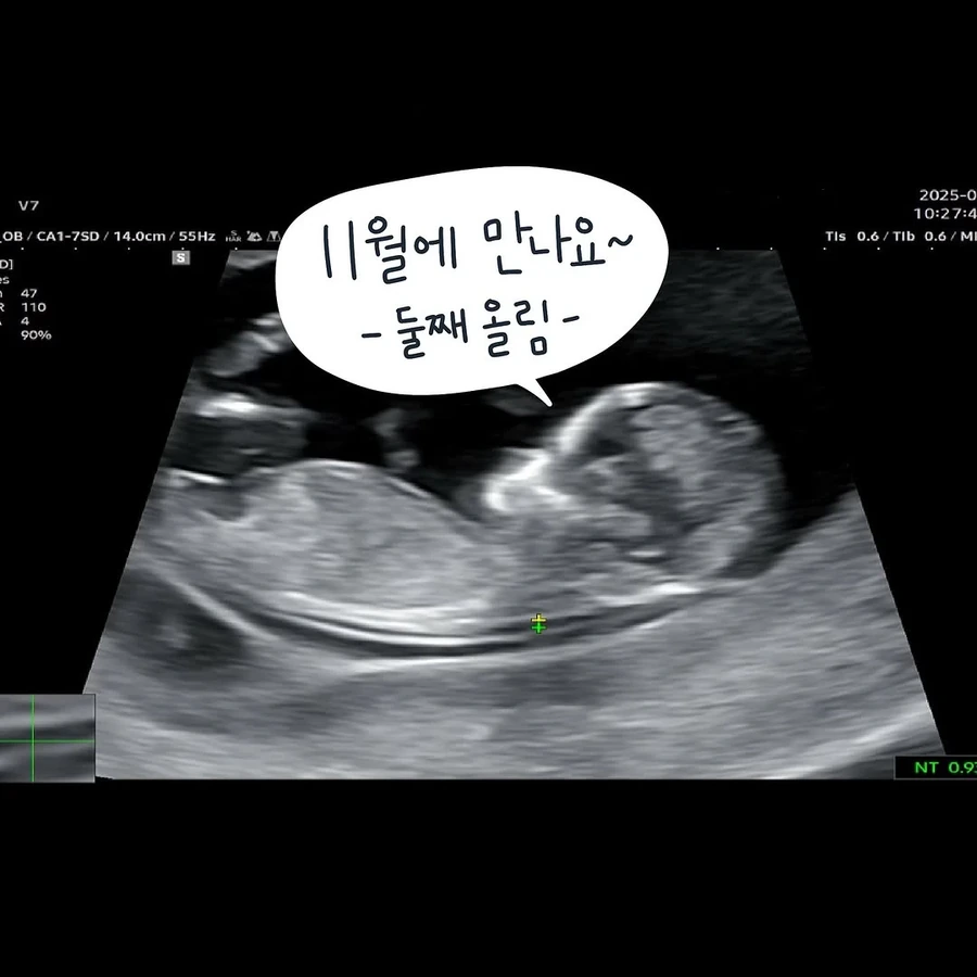 남편이 임신기간내내 해준 일 .manhwa_13.webp