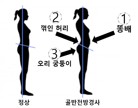 원신) 캐릭터들이 겪고있는 고질적인 질병.manga