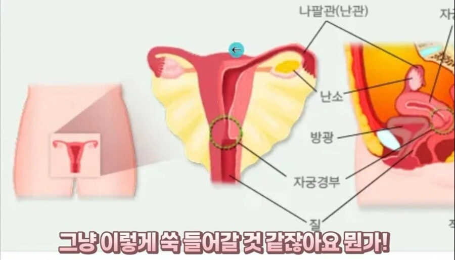의의로 ㅇㄹ망가 클리셰중 현실에서 절대 불가능한거 - 이미지 5