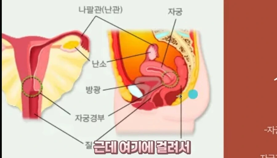 의의로 ㅇㄹ망가 클리셰중 현실에서 절대 불가능한거 - 이미지 6