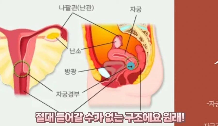 의의로 ㅇㄹ망가 클리셰중 현실에서 절대 불가능한거 - 이미지 7
