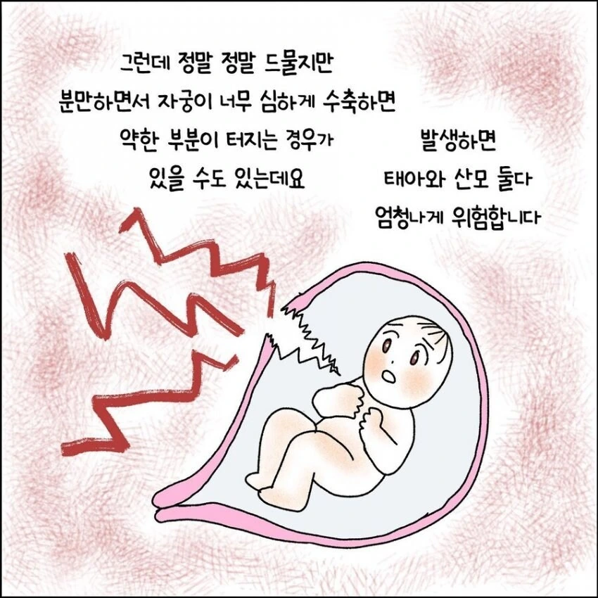 산부인과에서 출산 중 자궁이 파열되는 만화.manhwa - 이미지 3