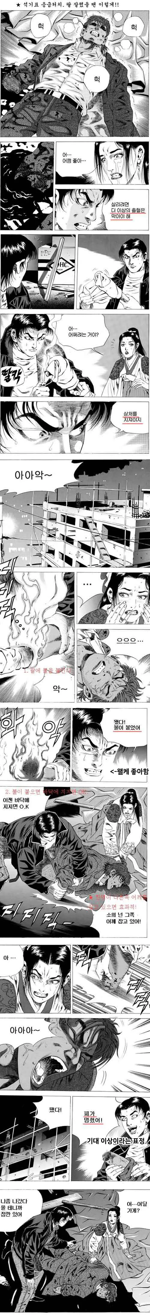 절단상처 났을때 보면 좋은 만화